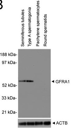 Western blot analysis shows that GFRA1 protein.jpg